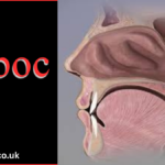 adenoidid